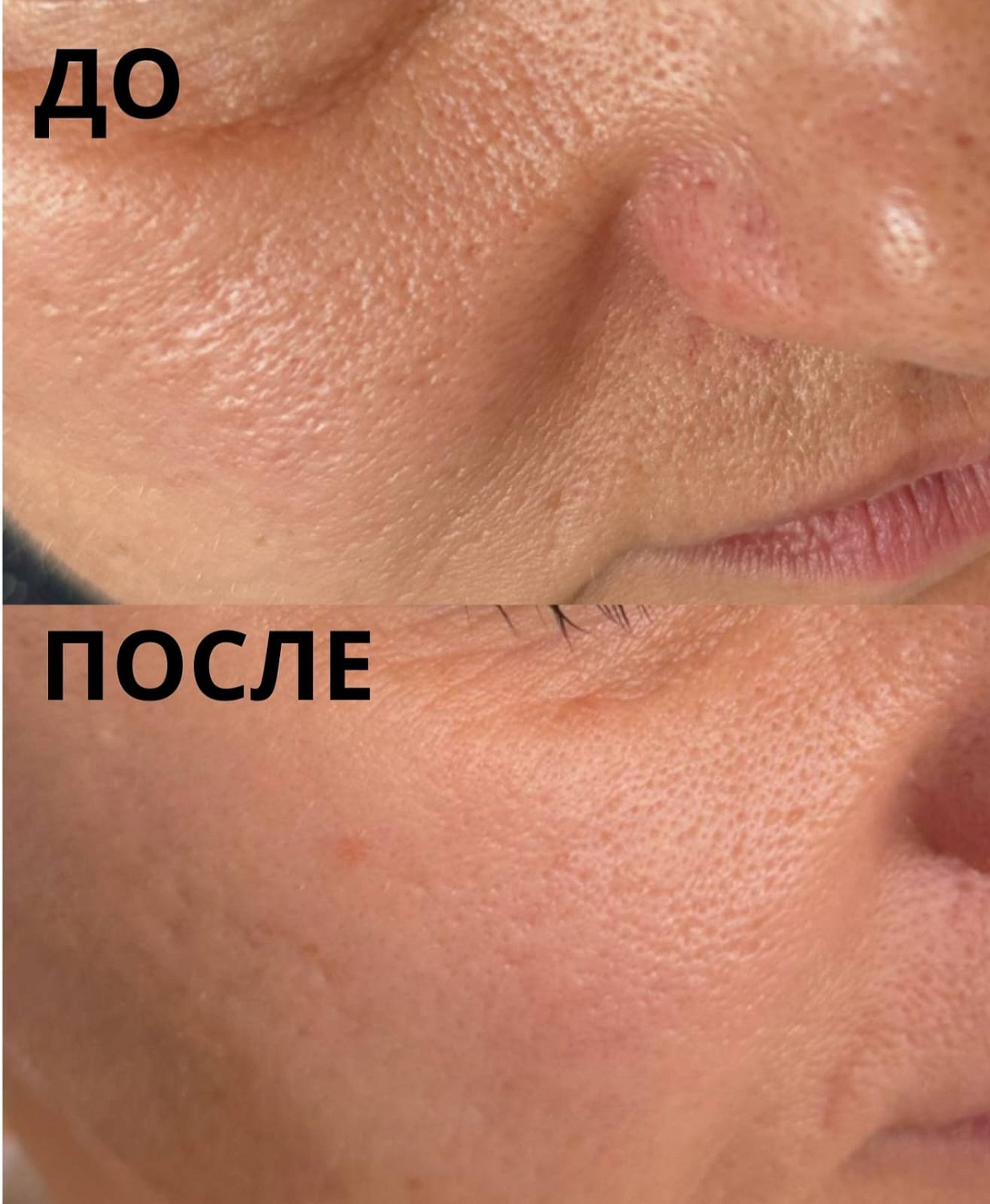 Базовый набор для жирной и проблемной кожи